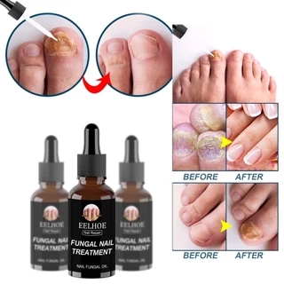 Tinh chất phục hồi móng EELHOE ANNIES 30ml/ 50ml loại bỏ nấm chăm sóc móng tay móng chân