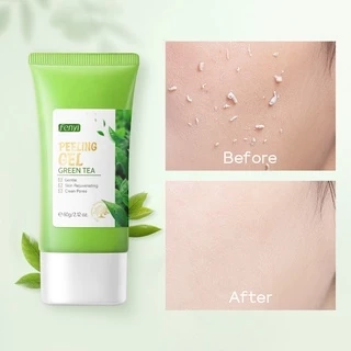Gel tẩy tế bào chết FENYI chiết xuất trà xanh tẩy mụn đầu đen làm sạch lỗ chân lông hiệu quả chuyên dụng 60g