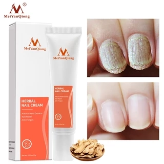 MeiYanQiong Kem Hỗ Trợ Giảm Bệnh Nấm Móng 15g