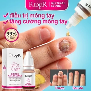 Tinh chất gừng RTOPR kháng khuẩn hỗ trợ giảm bệnh nấm móng chân 10ml