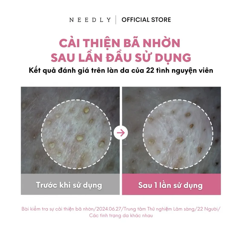 Ảnh Combo Toner Pad Needly Anti-Trouble Làm Sạch Bã Nhờn Căng Bóng 500G 120 Miếng 3