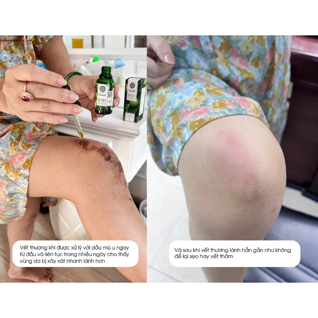 Ảnh Dầu mù u ép lạnh nguyên chất Tinh dầu Đất Việt dung tích 10ml và 30ml 2