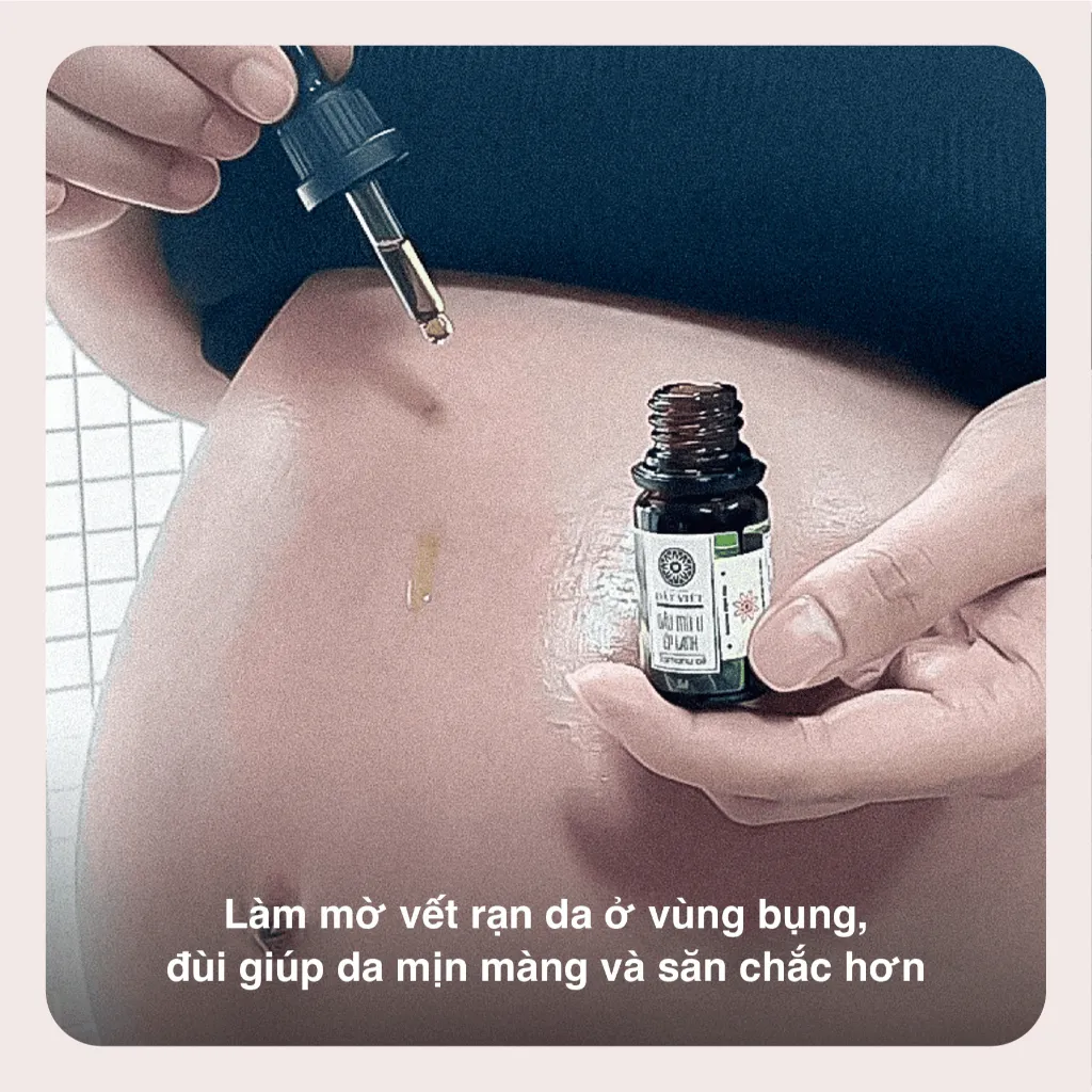 Ảnh Dầu mù u ép lạnh nguyên chất Tinh dầu Đất Việt dung tích 10ml và 30ml 4