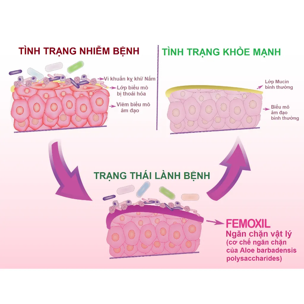 Ảnh Gel bôi nấm ngứa vùng kín FEMOXIL, sạch sâu se khít, hồng hào tự nhiên nhập khẩp danpharm, gói 3g 3