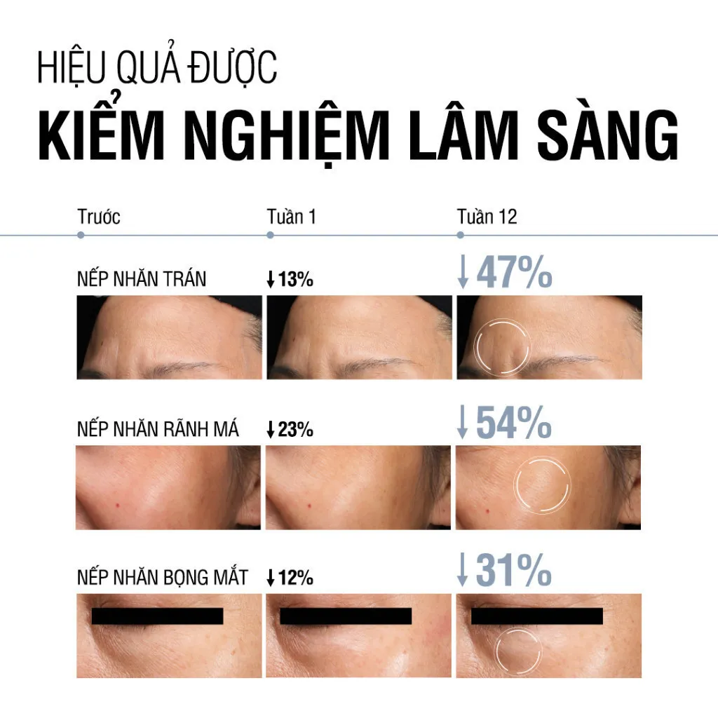 Ảnh Kem dưỡng Retinol Chống Lão Hóa Giảm Nhăn Neutrogena Visible Repair Regenerating Cream (50g) 4
