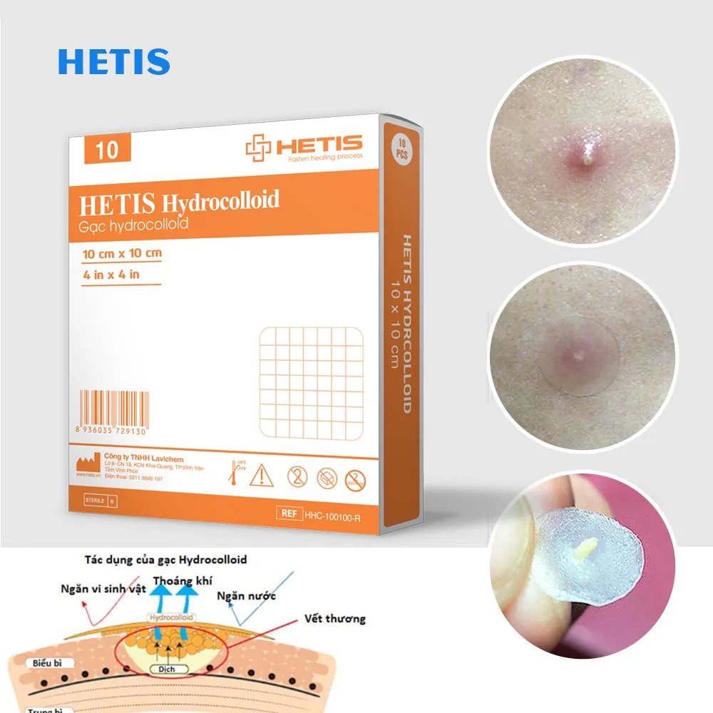Ảnh Miếng Dán Mụn, Vết Thương ALFASEPT HETIS HYDROCOLLOID Giúp Thấm hút Dịch, Loại Bỏ Những Mô Chết, Ngăn Ngừa Sẹo 2