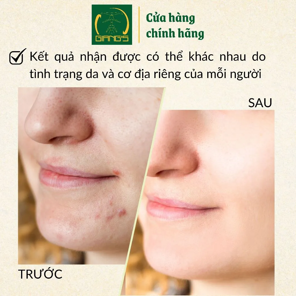 Ảnh Nước cân bằng (toner) giàu khoáng dành cho da hỗ hợp JASMINUM HERBAL EXTRACT TONER ALCOHOL-FREE 200ml - Giang's 3