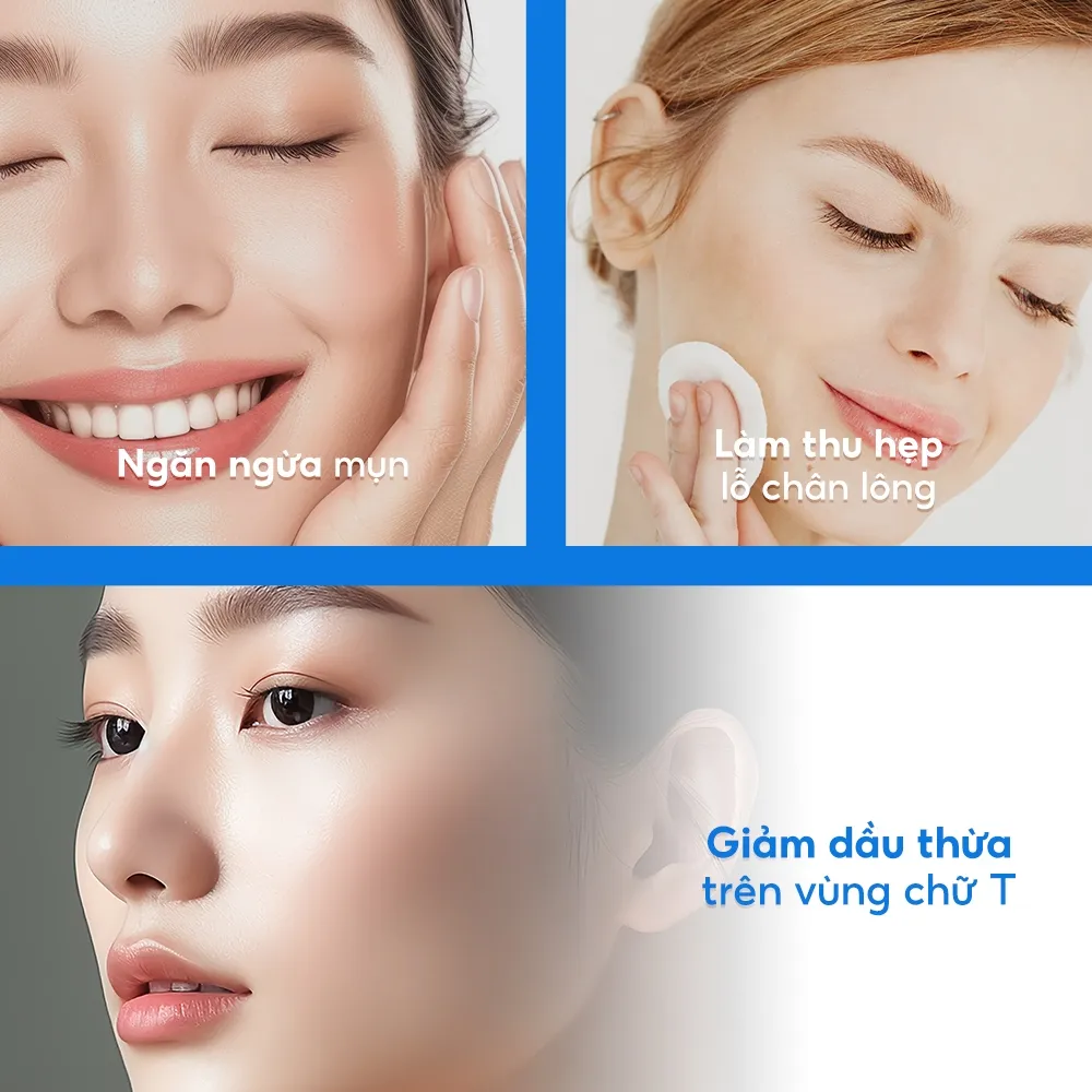 Ảnh Nước dưỡng dành cho da mụn Tenamyd Cosmetic (140ml/chai) 2