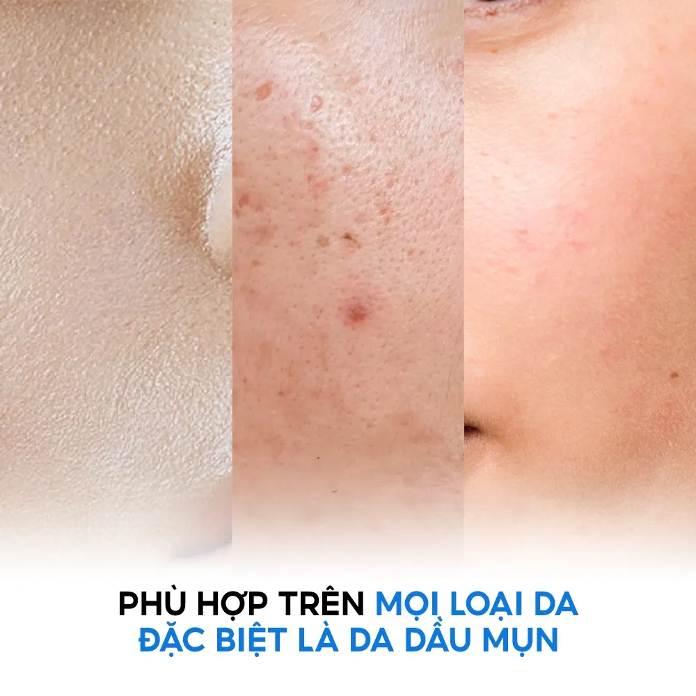 Ảnh Nước dưỡng dành cho da mụn Tenamyd Cosmetic (140ml/chai) 4