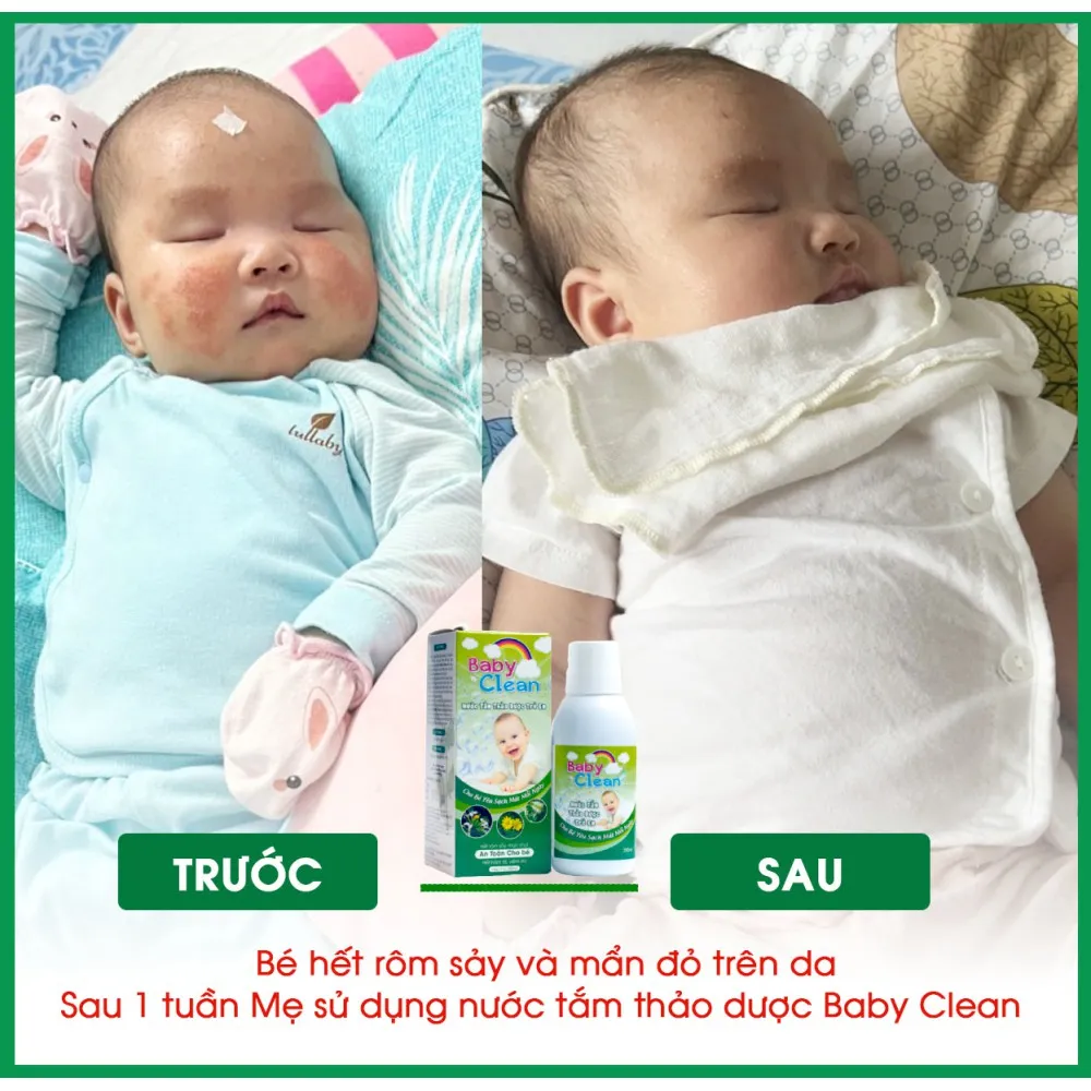 Ảnh Nước tắm thảo dược cho bé Baby Clean 250ml giảm rôm sảy, hăm tã, làm sạch và mát cơ thể cho bé 4