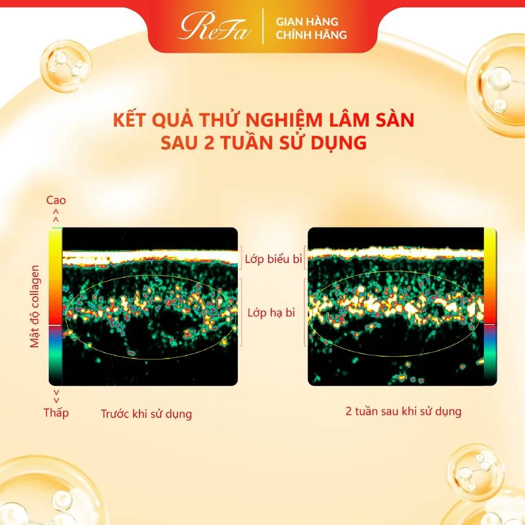 Ảnh ReFa Collagen Enrich+ 480ml - Thực phẩm bảo vệ sức khỏe ReFa Collagen Enrich+ 4
