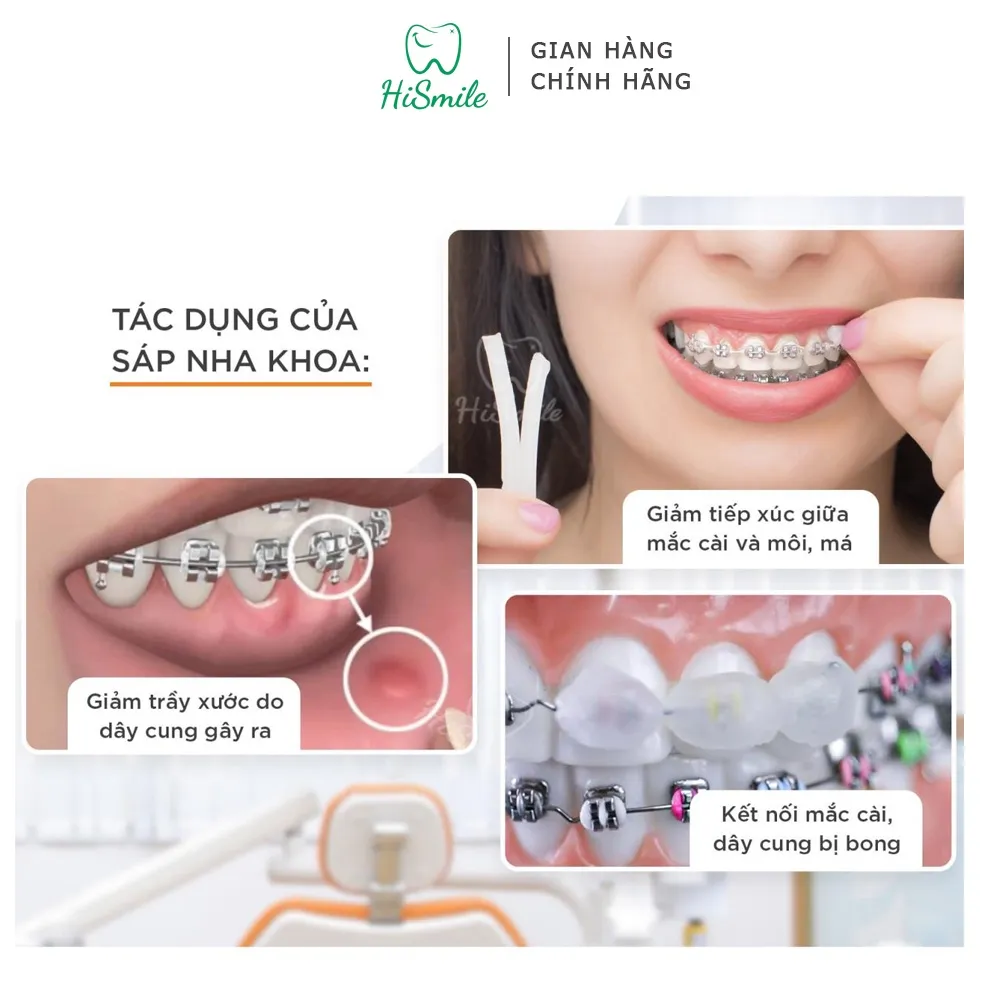 Ảnh SÁP NHA KHOA Dynaflex dành cho người chỉnh nha 2