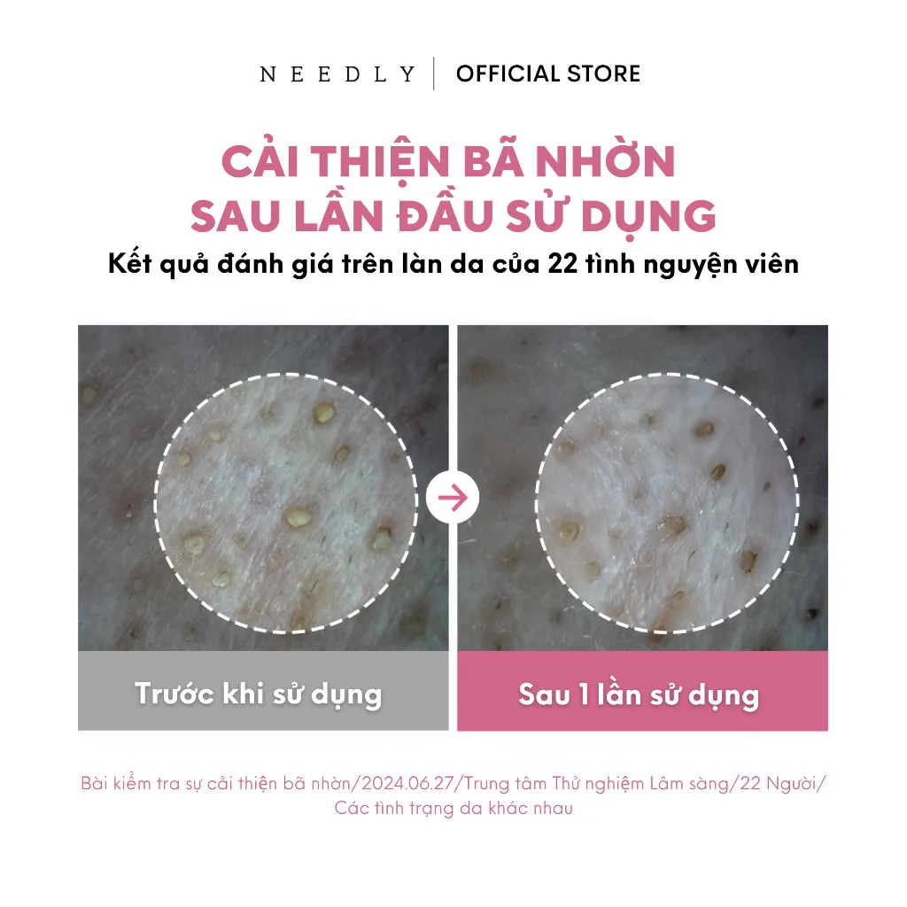 Ảnh Toner Pad Needly Anti-Trouble Làm Sạch Bã Nhờn Căng Bóng 250G 60 Miếng 4