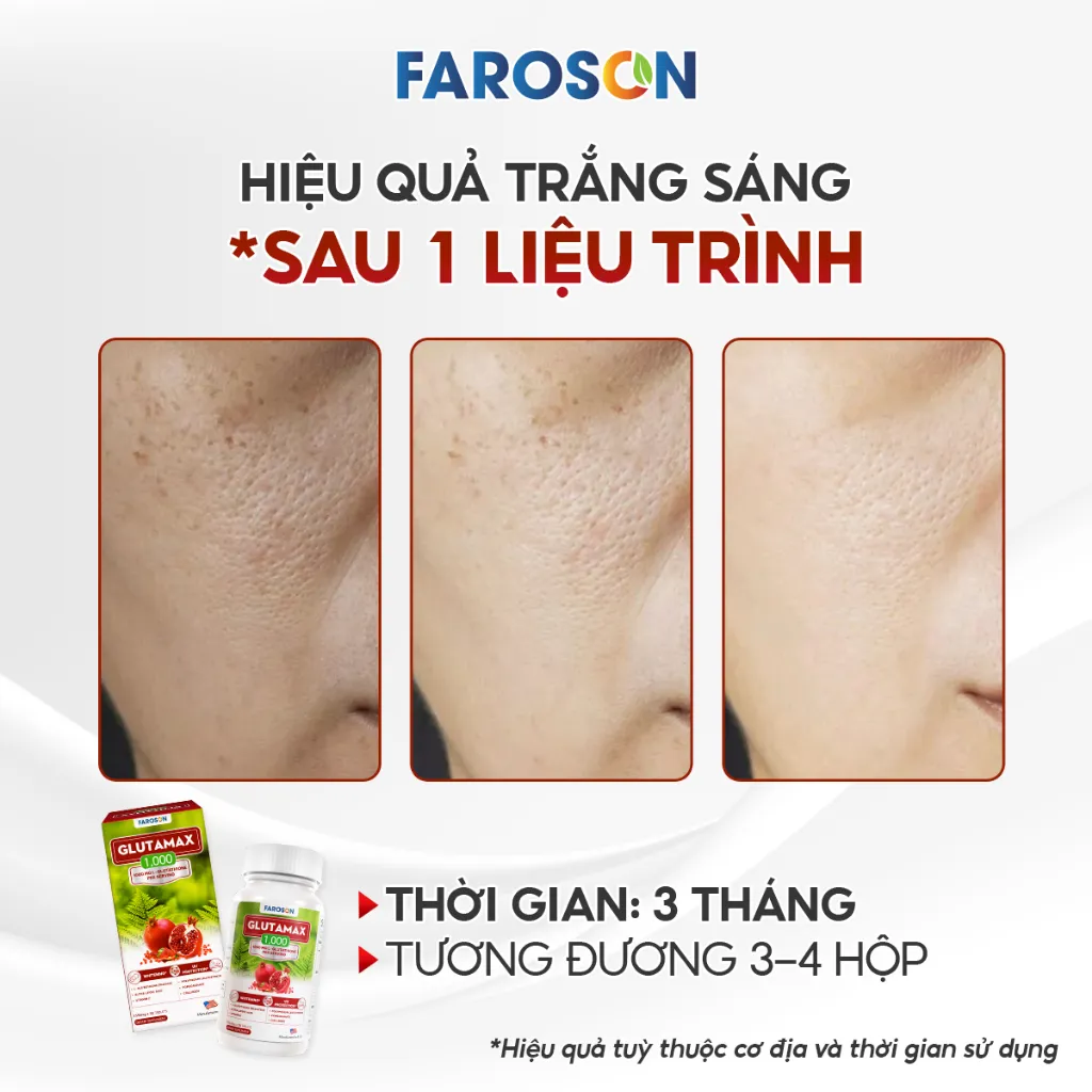 Ảnh TPBVSK Viên Uống Trắng Da Chứa Glutathione Faroson Glutamax 1000 Hỗ Trợ Sáng Da Mờ Thâm Nám Chống Nắng Hộp 30 Viên 4