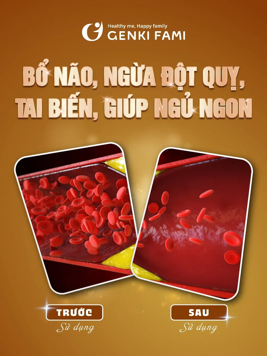 Ảnh Viên Uống Bổ Não, Ngừa Đột Quỵ Tai Biến, Giúp Ngủ Ngon Nattokinase 3000FU Natto Ichou Genki Fami Nhật Bản 4