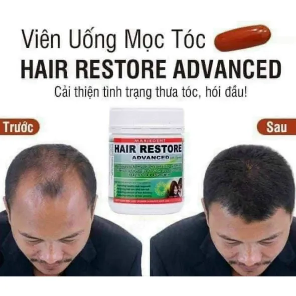 Ảnh Viên Uống Mọc Tóc Hair Restore Advanced Giúp Giảm Tình Trạng Gãy Rụng Tóc Và Thúc Đẩy Tóc Con Phát Triển 1 Lọ 60 Viên 2