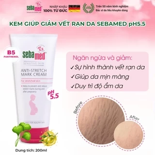 Kem ngăn ngừa rạn da bà bầu Sebamed Anti-Stretch Mark Cream pH5.5 (200ml)