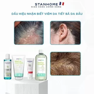 Combo viêm da đầu tiết bã Stanhome Balance Shampoo-Sos Cica-Gentle shampoo - Gentle Conditioner