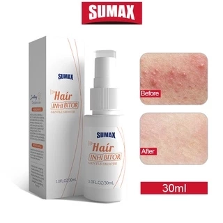 Chai xịt ức chế mọc lông SUMAX thích hợp cho vùng tay/ chân/ nách/ bikini cho nam nữ 30ml100g